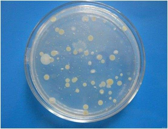 菌落總數,水質在線91抖音下载入口